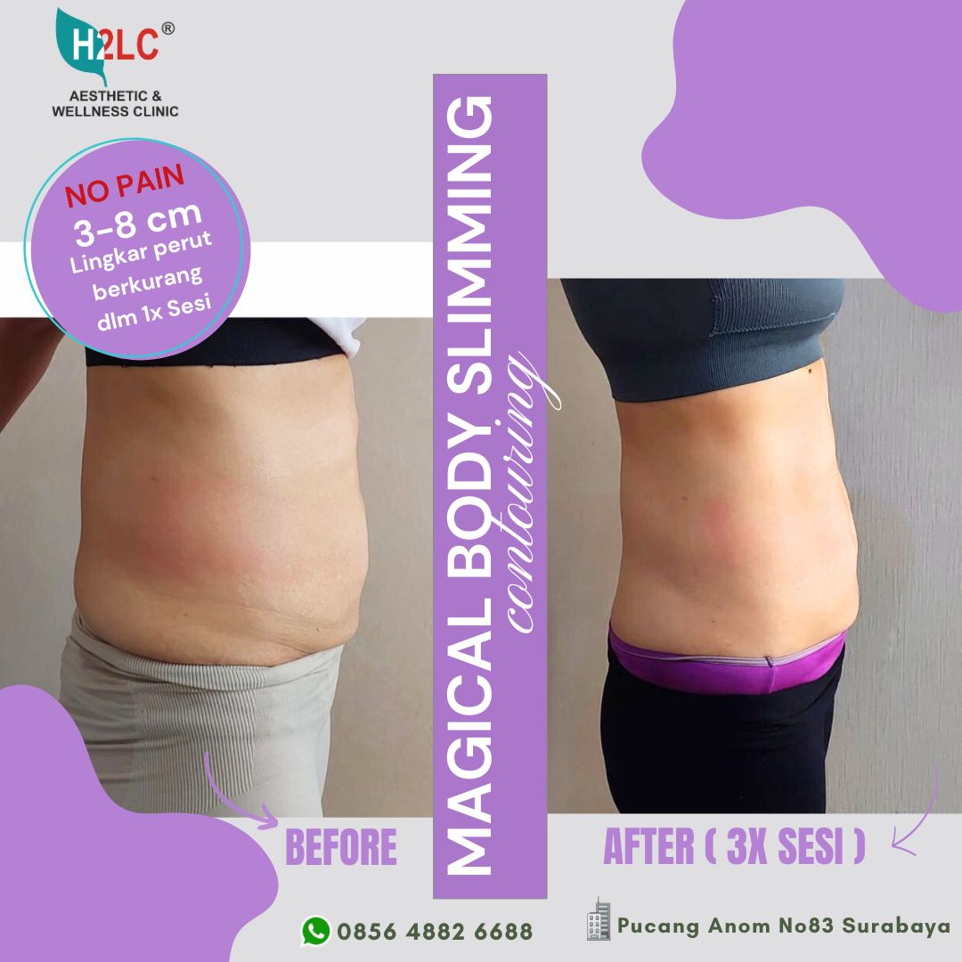 Hasil Magic Slim Korea Body