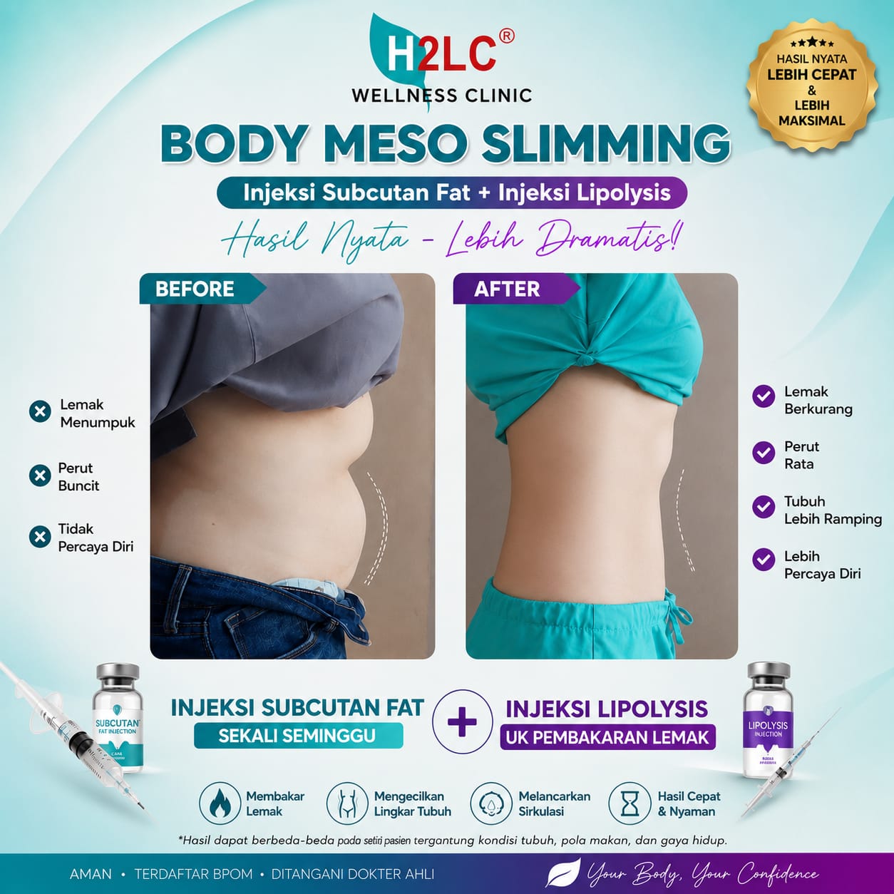 Hasil Suntik Slimming Perut