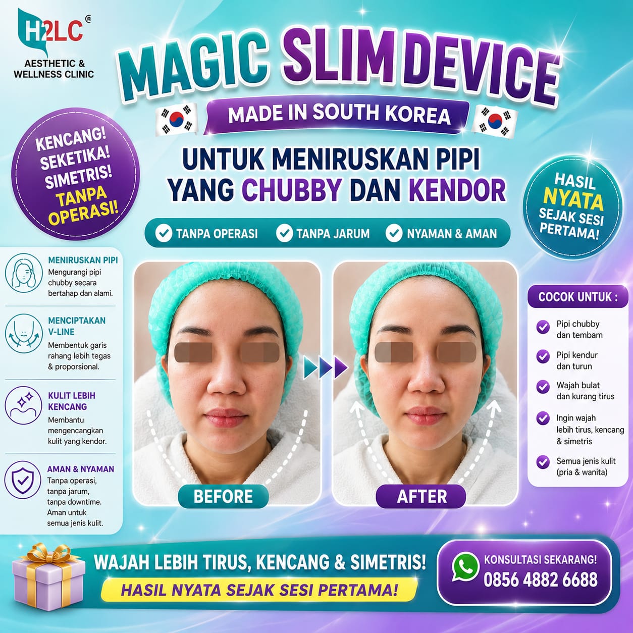 Hasil Magic Slim Korea Wajah